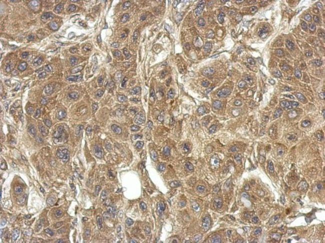 RPS4Y1 Antibody in Immunohistochemistry (IHC)