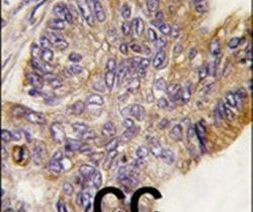 RSK1 Antibody in Immunohistochemistry (IHC)
