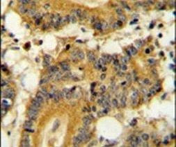 RSK1 Antibody in Immunohistochemistry (IHC)