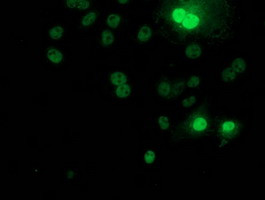 RPS6KB1 Antibody in Immunocytochemistry (ICC/IF)