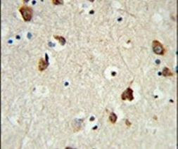 RPS6KB2 Antibody in Immunohistochemistry (IHC)