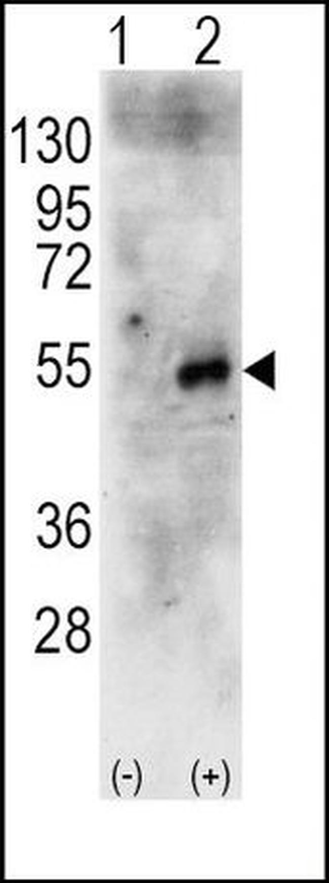 RPS6KB2 Antibody in Western Blot (WB)