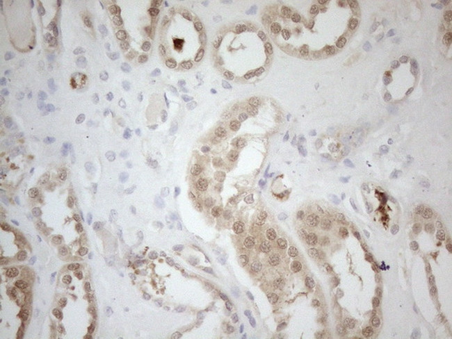 RPS6KC1 Antibody in Immunohistochemistry (Paraffin) (IHC (P))