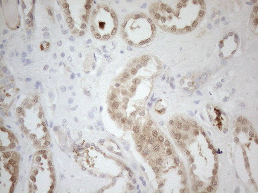 RPS6KC1 Antibody in Immunohistochemistry (Paraffin) (IHC (P))