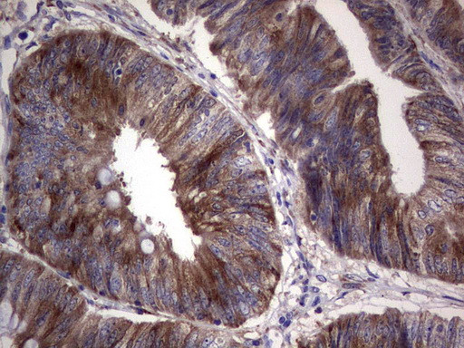 RRM1 Antibody in Immunohistochemistry (Paraffin) (IHC (P))
