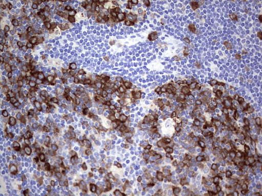 RRM1 Antibody in Immunohistochemistry (Paraffin) (IHC (P))