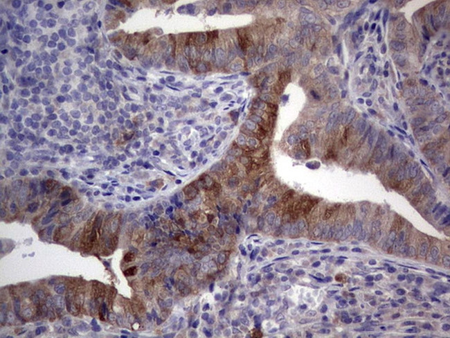 RRM1 Antibody in Immunohistochemistry (Paraffin) (IHC (P))