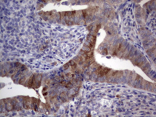 RRM1 Antibody in Immunohistochemistry (Paraffin) (IHC (P))