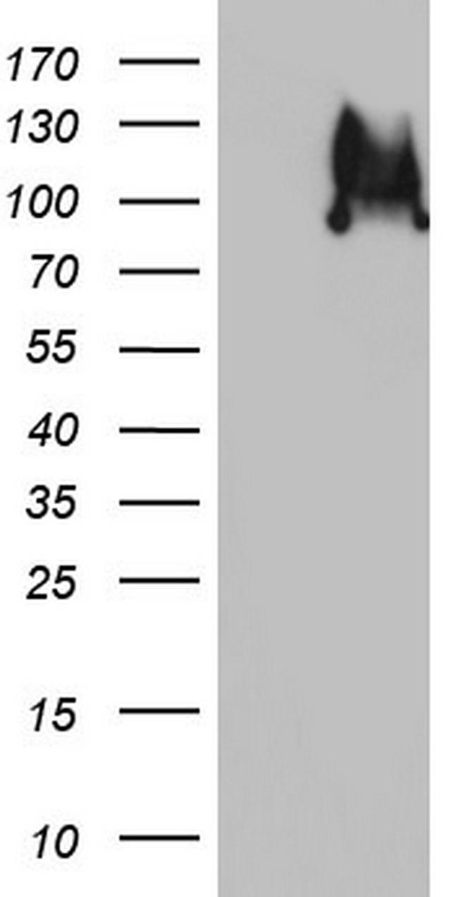 RRM1 Antibody in Western Blot (WB)