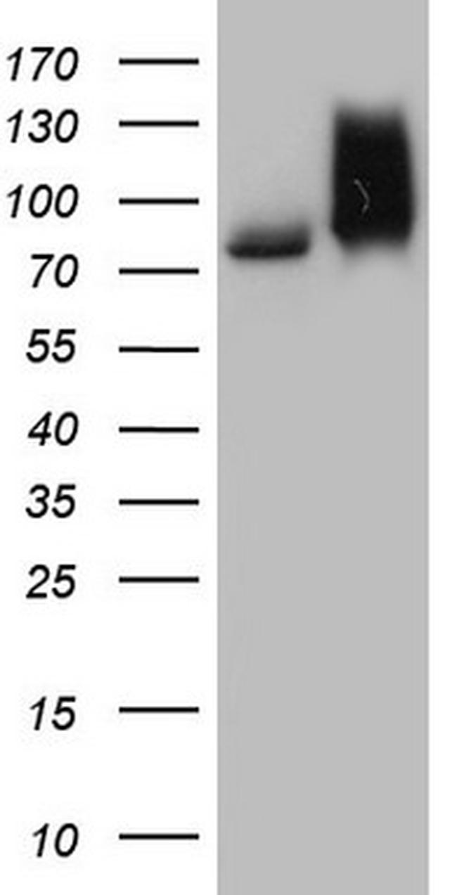 RRM1 Antibody in Western Blot (WB)