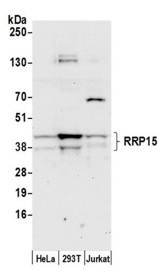 RRP15 Antibody in Western Blot (WB)