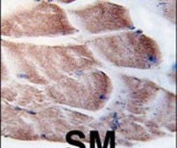 RSK2 Antibody in Immunohistochemistry (IHC)