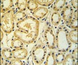 MRPS25 Antibody in Immunohistochemistry (IHC)
