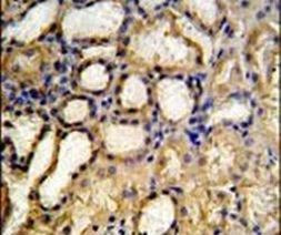 MRPS33 Antibody in Immunohistochemistry (IHC)