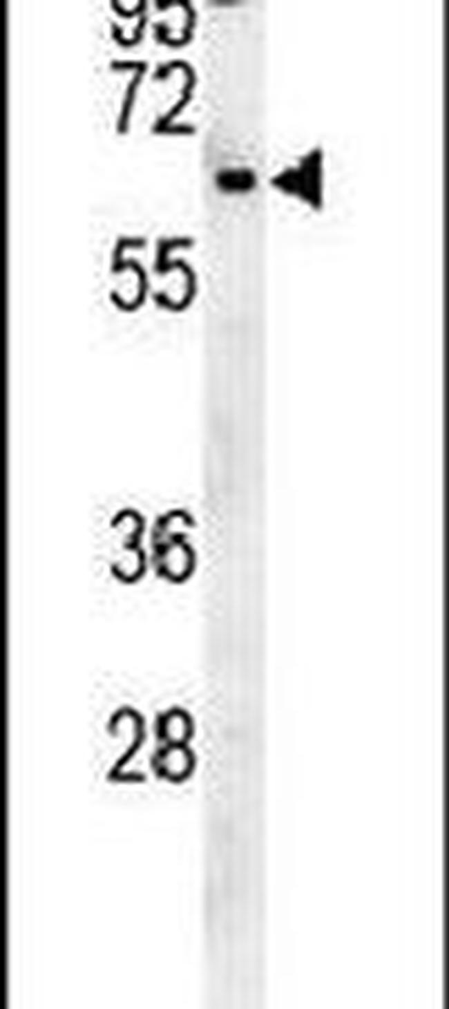 RTKN2 Antibody in Western Blot (WB)