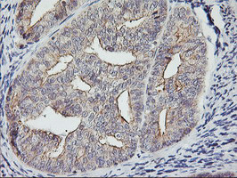 RTN4IP1 Antibody in Immunohistochemistry (Paraffin) (IHC (P))