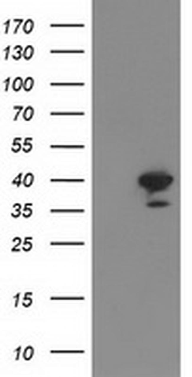 RTN4IP1 Antibody in Western Blot (WB)