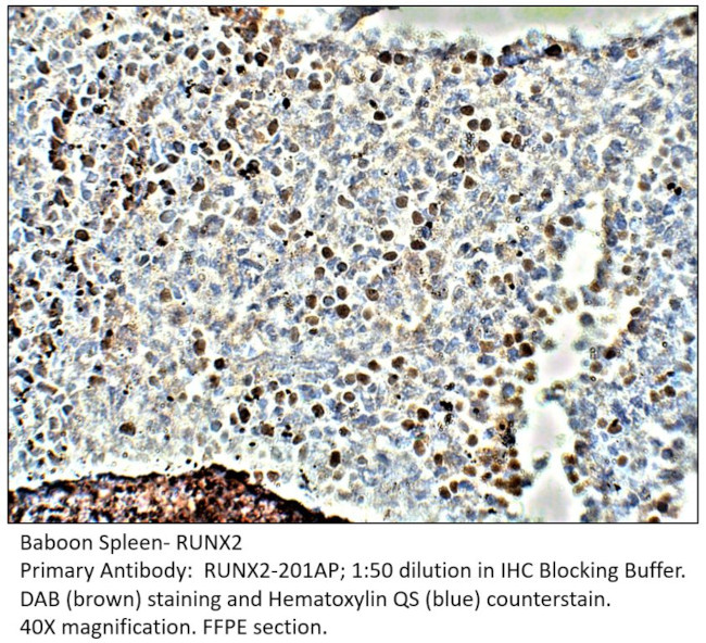 RUNX2 Antibody in Immunohistochemistry (IHC)