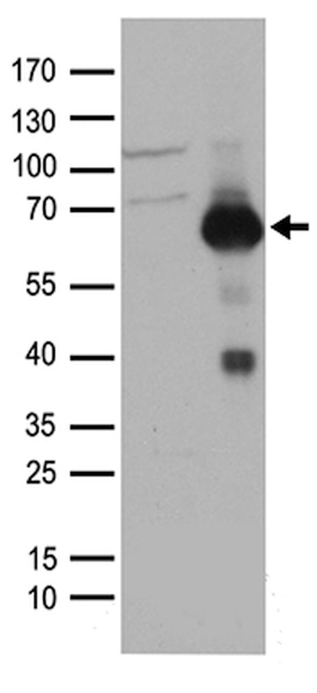 RUNX2 Antibody in Western Blot (WB)