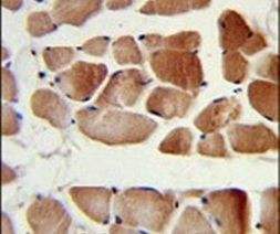 RUVBL1 Antibody in Immunohistochemistry (IHC)