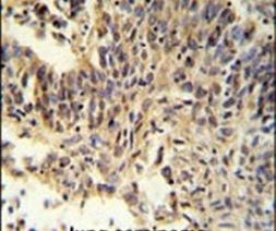 RXRA Antibody in Immunohistochemistry (IHC)
