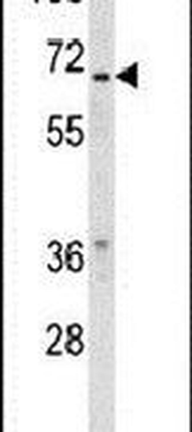 RXRB Antibody in Western Blot (WB)