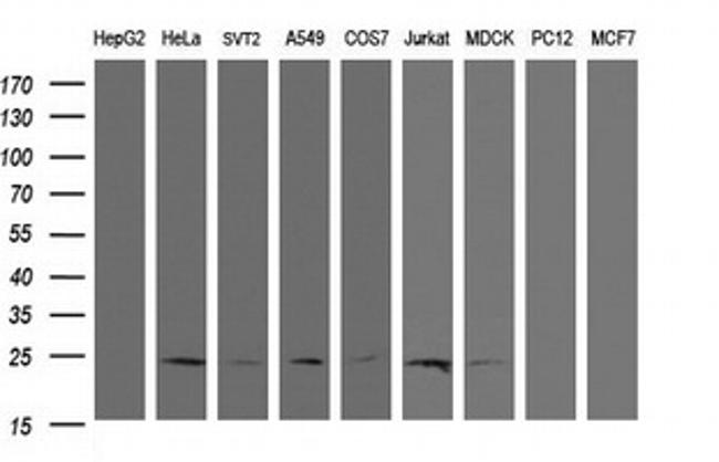RYBP Antibody in Western Blot (WB)