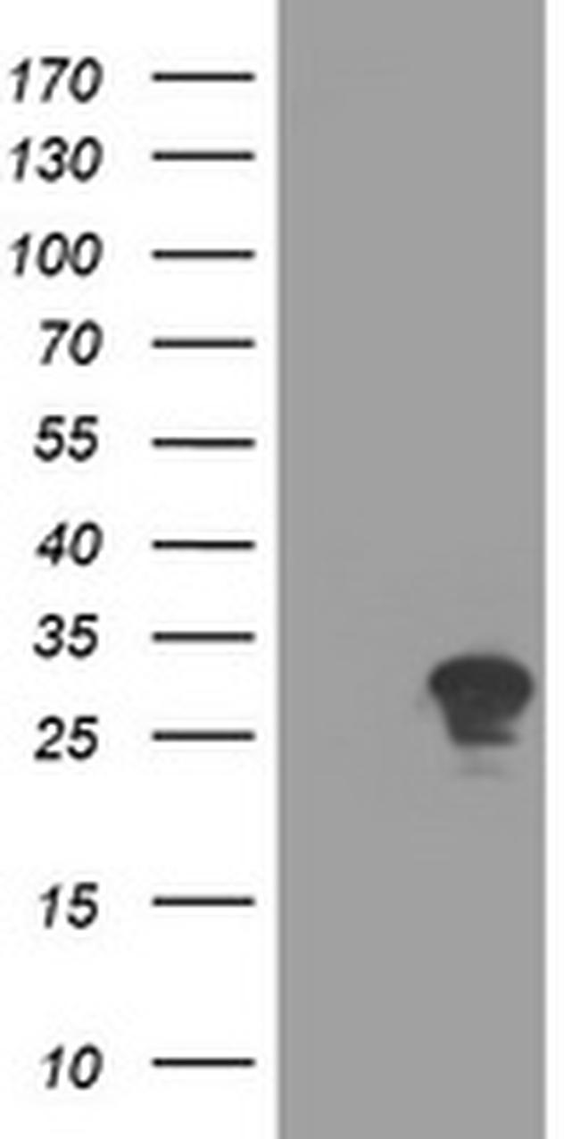 RYBP Antibody in Western Blot (WB)