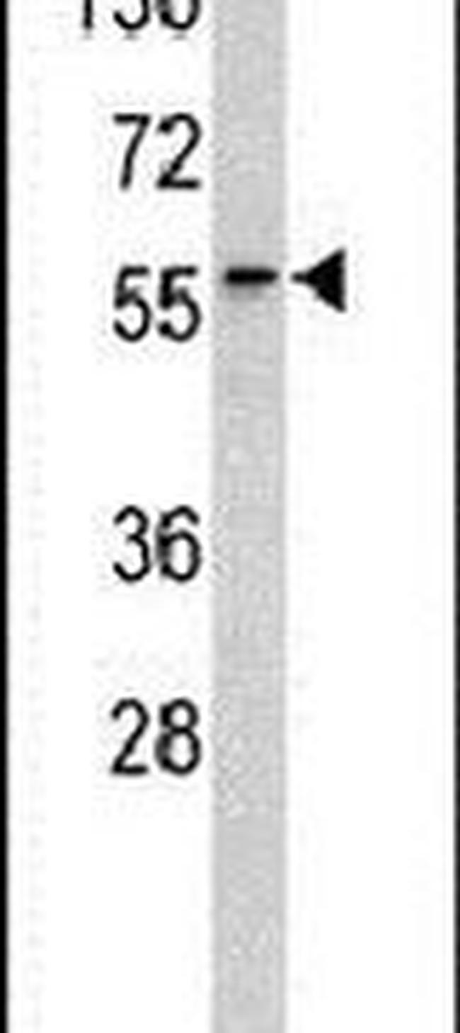 RYK Antibody in Western Blot (WB)