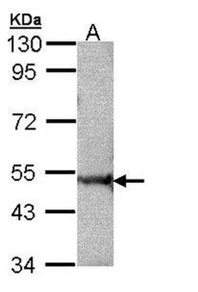 Rabex-5 Antibody in Western Blot (WB)