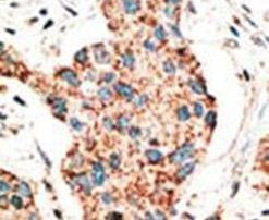 RAD9 Antibody in Immunohistochemistry (IHC)