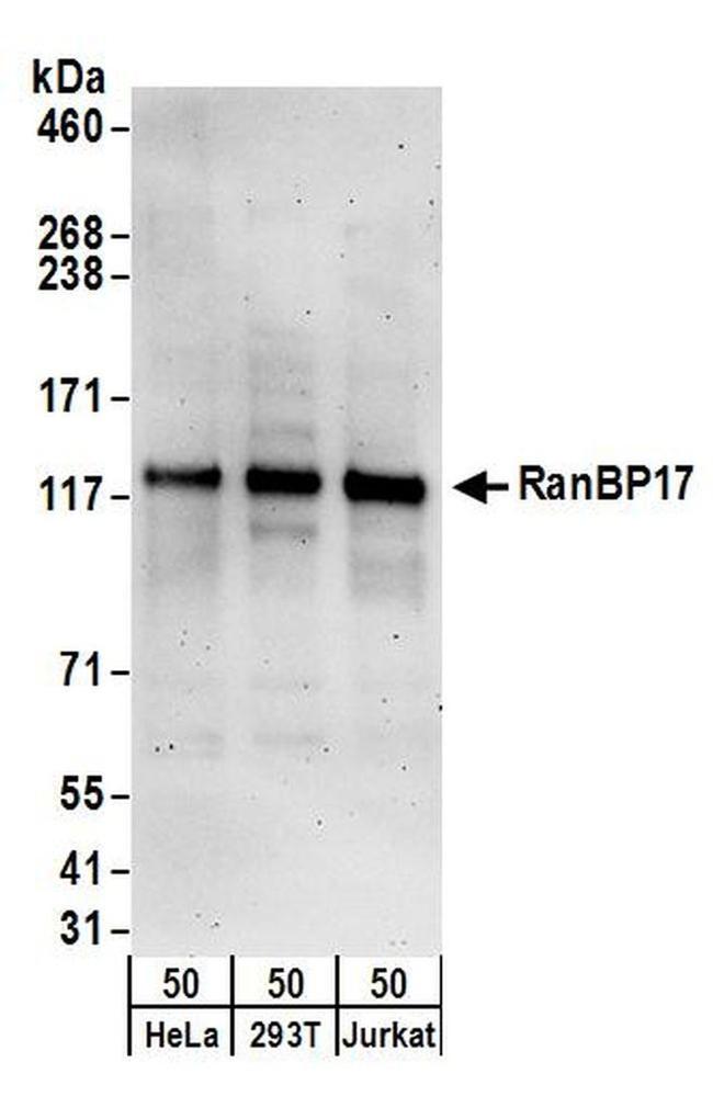 RanBP17 Antibody in Western Blot (WB)