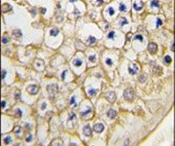 TRPV3 Antibody in Immunohistochemistry (IHC)