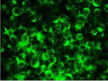 RTN1 Antibody in Immunocytochemistry (ICC/IF)