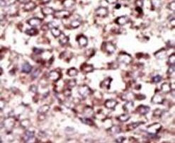 Ribophorin II Antibody in Immunohistochemistry (IHC)