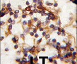 RICTOR Antibody in Immunohistochemistry (IHC)