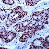 RXRG Antibody in Immunohistochemistry (IHC)