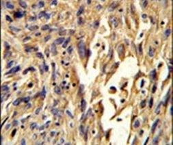 S100A10 Antibody in Immunohistochemistry (IHC)