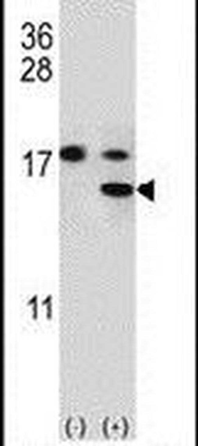 S100A11 Antibody in Western Blot (WB)