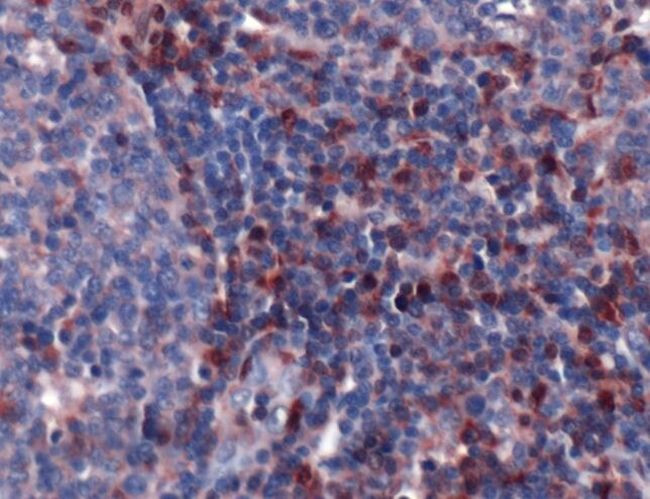 S100A4 Antibody in Immunohistochemistry (IHC)