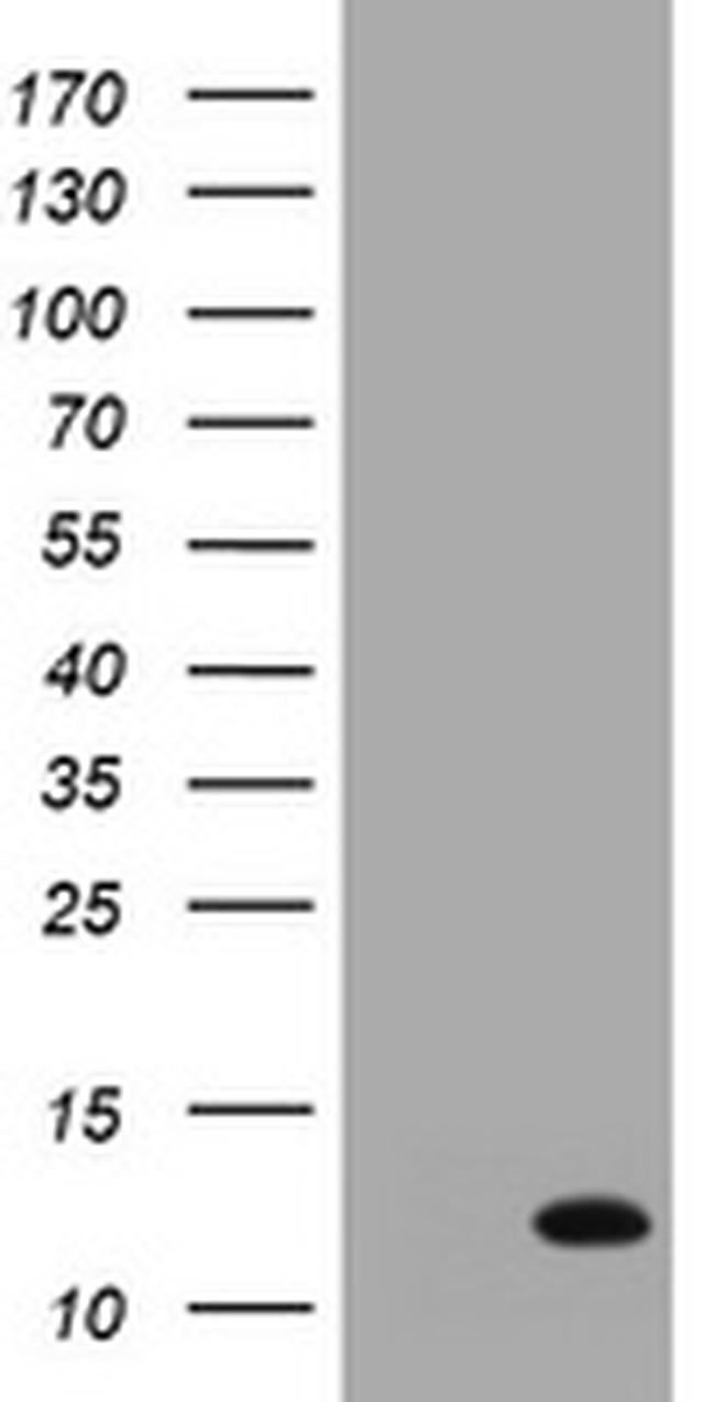 S100A6 Antibody in Western Blot (WB)
