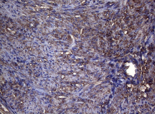 S100A9 Antibody in Immunohistochemistry (Paraffin) (IHC (P))