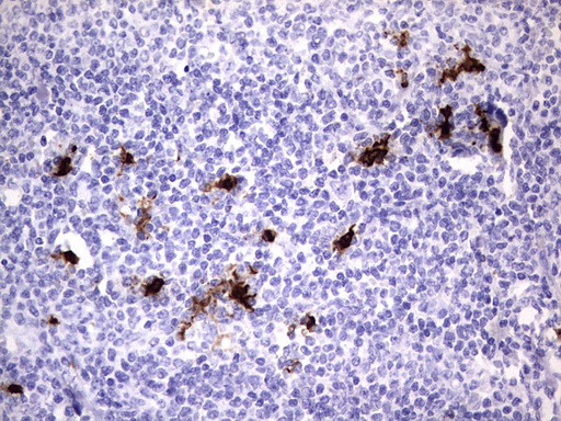 S100A9 Antibody in Immunohistochemistry (Paraffin) (IHC (P))