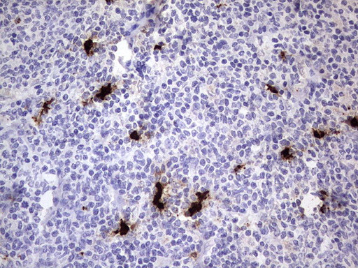 S100A9 Antibody in Immunohistochemistry (Paraffin) (IHC (P))