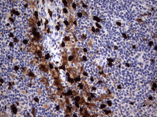 S100A9 Antibody in Immunohistochemistry (Paraffin) (IHC (P))