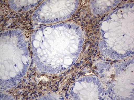 S100A9 Antibody in Immunohistochemistry (Paraffin) (IHC (P))
