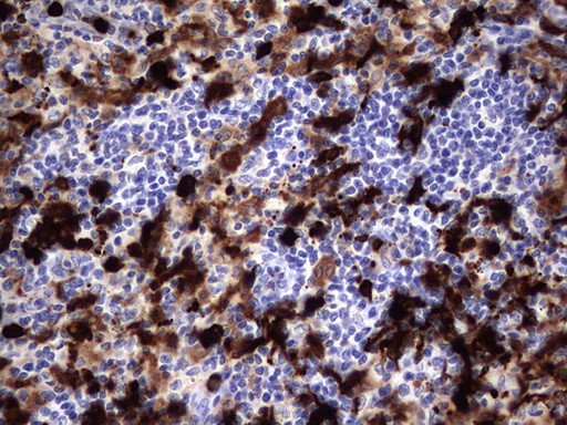 S100A9 Antibody in Immunohistochemistry (Paraffin) (IHC (P))