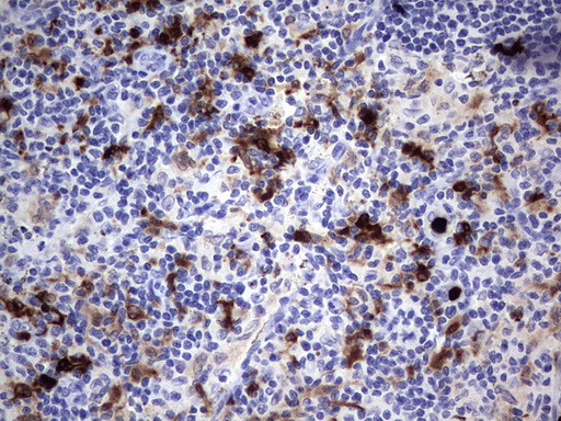 S100A9 Antibody in Immunohistochemistry (Paraffin) (IHC (P))
