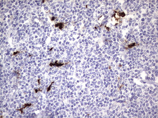 S100A9 Antibody in Immunohistochemistry (Paraffin) (IHC (P))