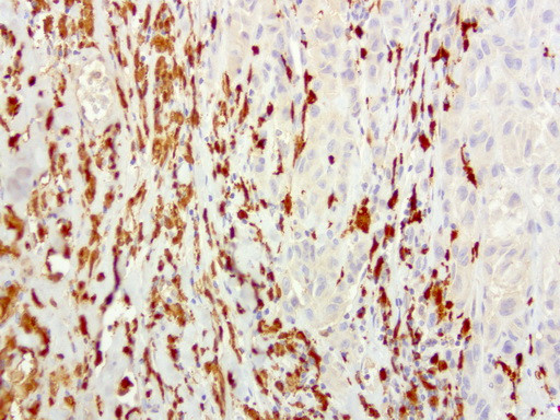 S100A9 Antibody in Immunohistochemistry (Paraffin) (IHC (P))
